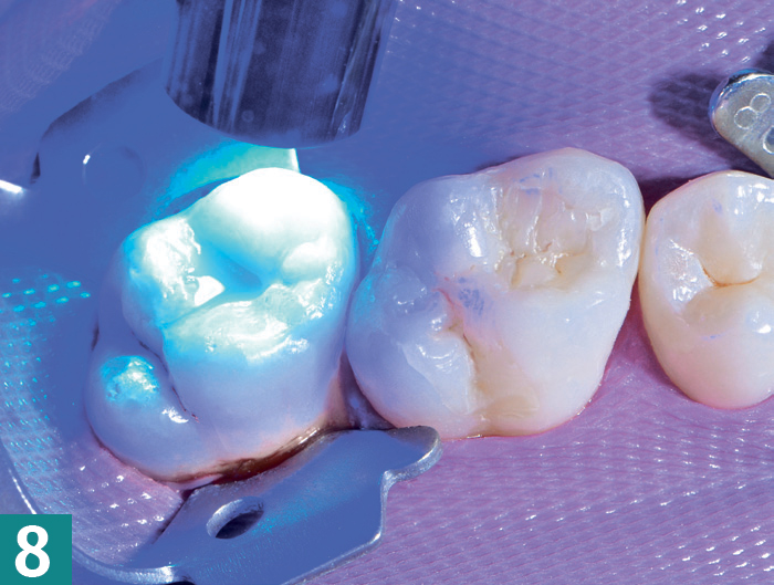 Реставрация DMG Constic - этап 8